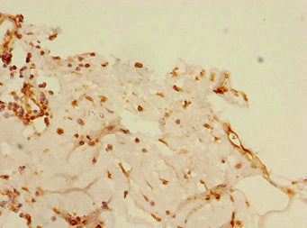 BLID Antibody