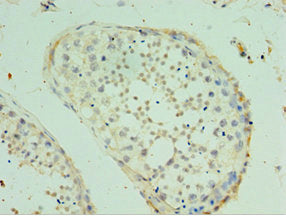 SPAG16 Antibody