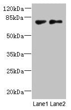 TTC30B Antibody