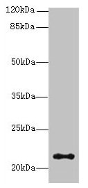 JAGN1 Antibody