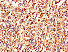 LSMEM1 Antibody