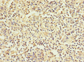 WFDC11 Antibody
