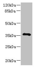 GIMAP7 Antibody