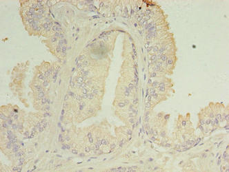 C11orf45 Antibody