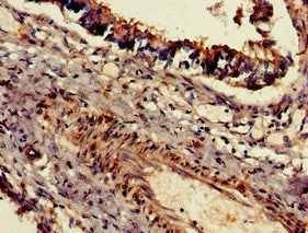 DNAH5 Antibody
