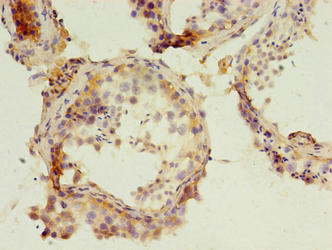 PARD3 Antibody
