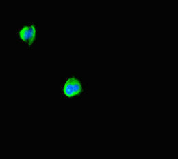 ABHD5 Antibody