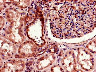 TGFBRAP1 Antibody