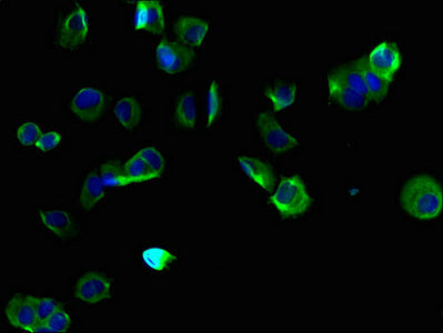 TMEM255B Antibody