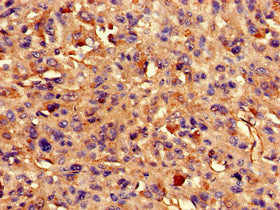 ARAP3 Antibody