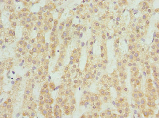 ST8SIA4 Antibody