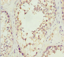 SLC9A6 Antibody