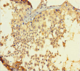 BCL2L2 Antibody