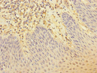 CR1 Antibody
