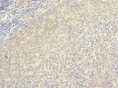 BORCS5 Antibody
