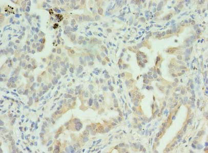 S100PBP Antibody