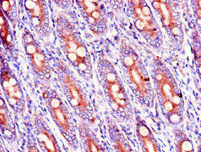 RAB39B Antibody