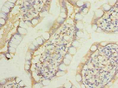 LRRC39 Antibody