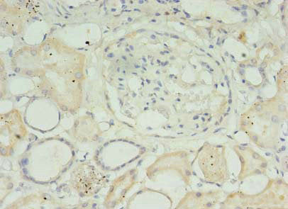MED30 Antibody