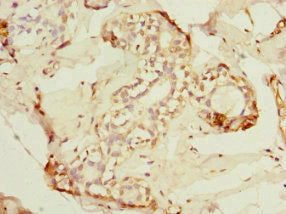 ADAD1 Antibody