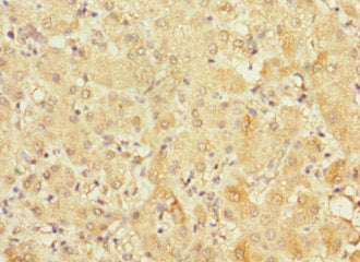 FRMD6 Antibody