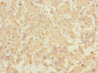 RCHY1 Antibody