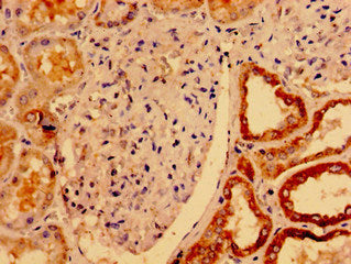 UCN2 Antibody