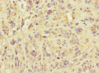 IMMP2L Antibody
