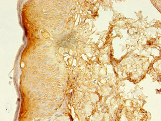 LSMEM2 Antibody