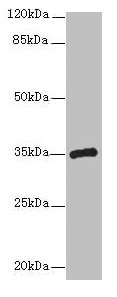CPXCR1 Antibody