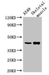 PPM1K Antibody