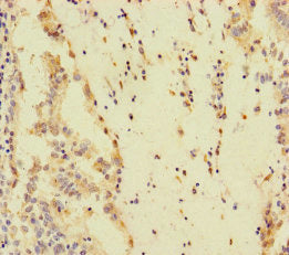 SPEM1 Antibody