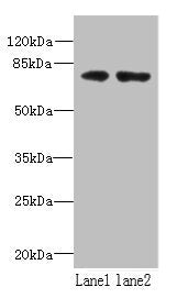 WDTC1 Antibody