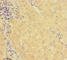 KDM1B Antibody