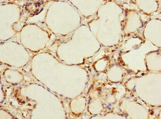 ADCY4 Antibody
