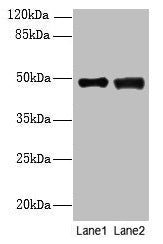 DBF4B Antibody
