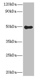 GSDMB Antibody