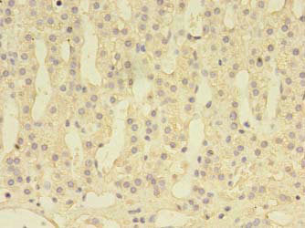DENND1A Antibody