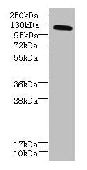 DIS3L Antibody