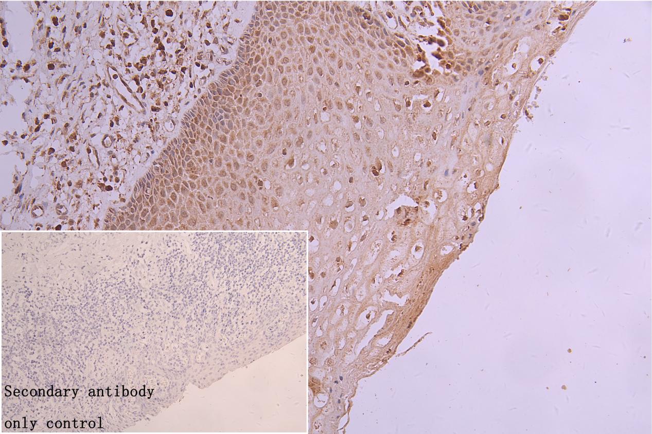 SLC22A17 Antibody