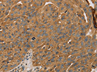 PARP11 Antibody