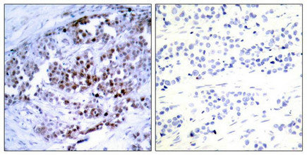 Phospho-BCL2 (Ser70) Antibody