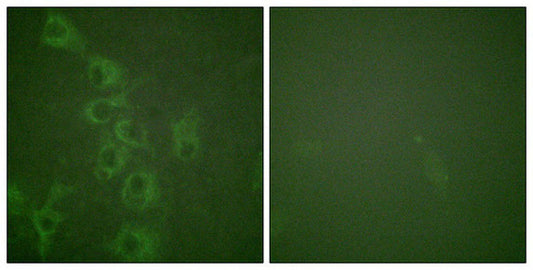 Phospho-HRH1 (Ser398) Antibody