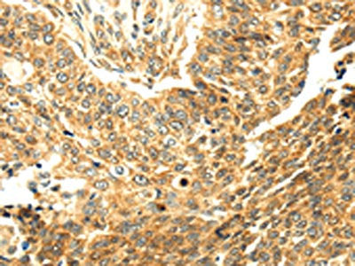 SERPINA12 Antibody