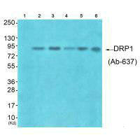 DNM1L (Ab-637) Antibody