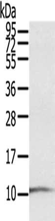 S100P Antibody
