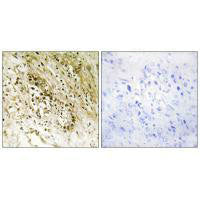 PDZD2 Antibody