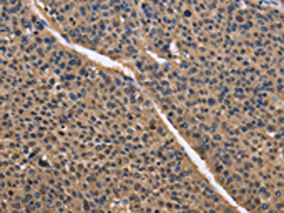 IDH1 Antibody