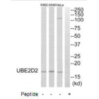 UBE2D2 Antibody