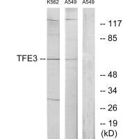 TFE3 Antibody